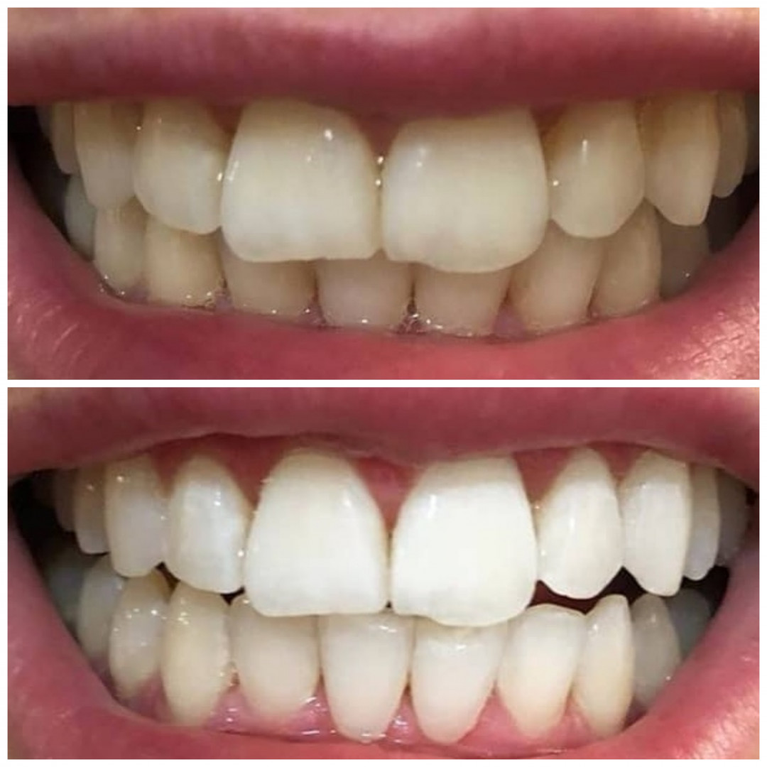 Dr Pantazis - Dental & Beauty Clinic #beograd Zubi