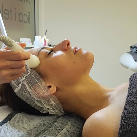 Nevena beauty centar #beograd Mezoterapija lica Mezoporacija + alginat maska