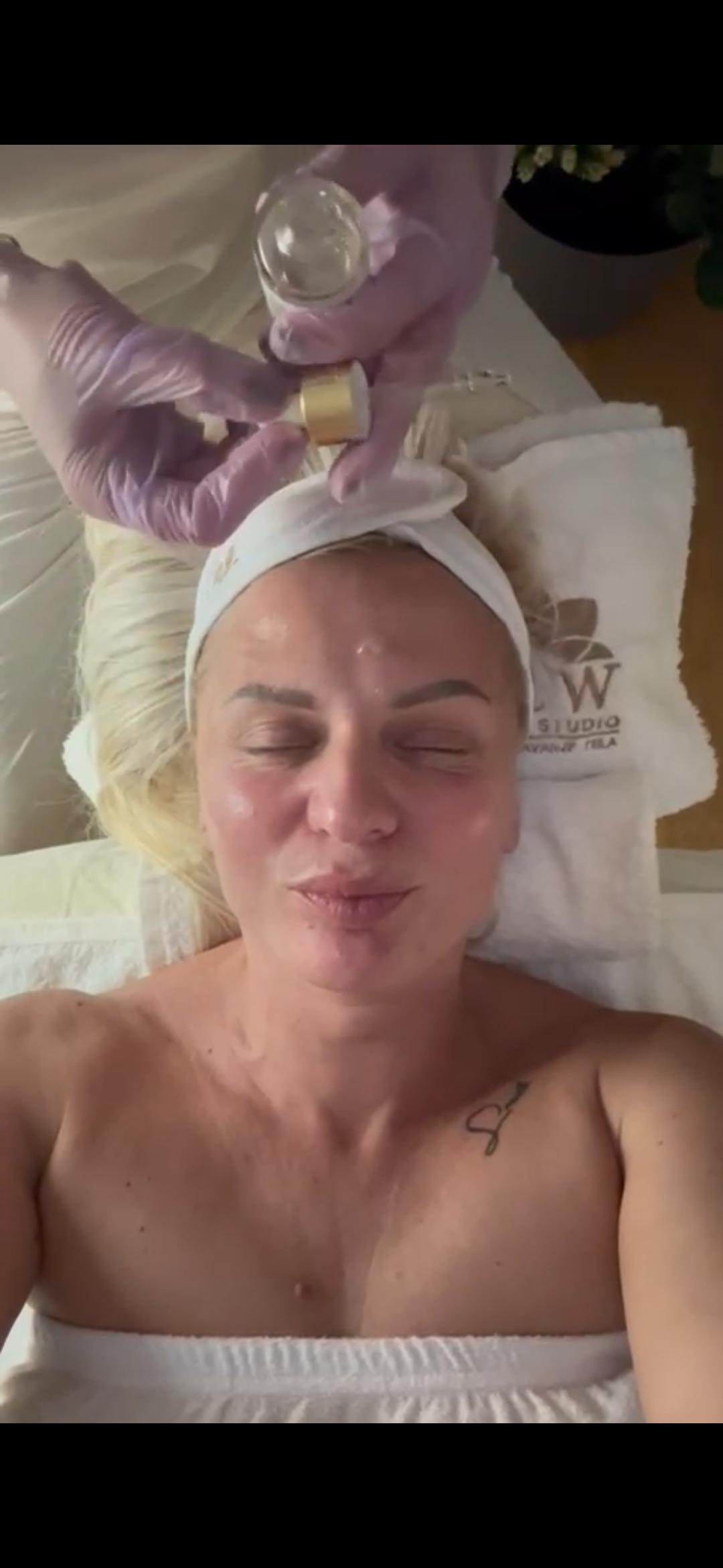 Dermapen microneedling tretman lica;lica,vrata i dekoltea - Glow Holistic Studio, Beograd Dermaroler i dermapen Lice Dermaroler i dermapen, Beograd, Novi Beograd blokovi, Belville, Savski kej