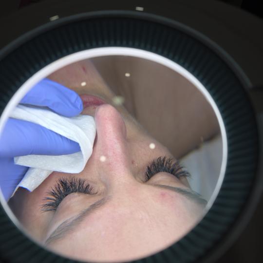 Starmedic #beograd Tretman lica Klasičan tretman lica + dijamantski piling