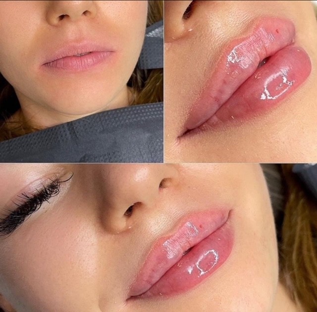 Estetik beauty centar, Pančevo LookBook