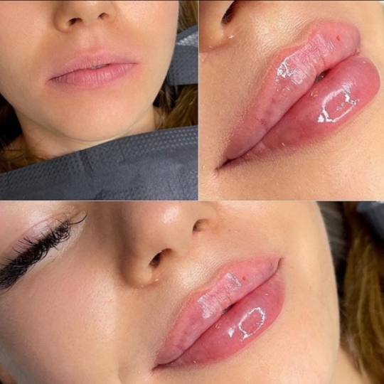 Estetik beauty centar #pancevo