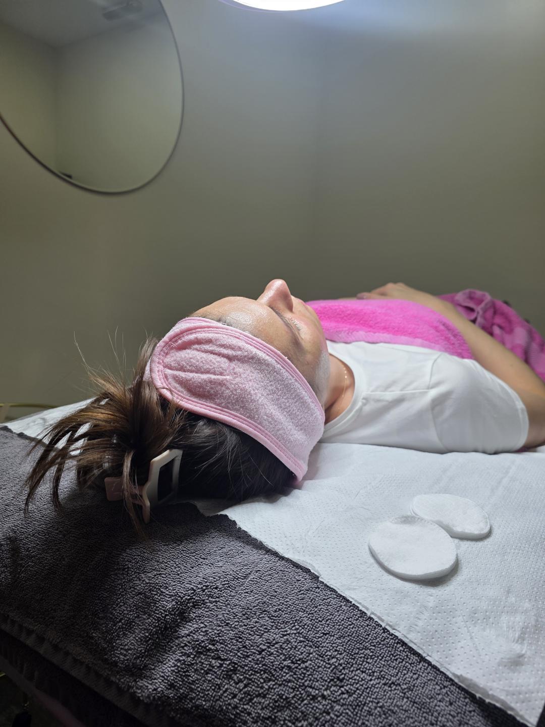 Holivudski sjaj - Jessner - Starmedic, Beograd Dermaroler i dermapen Lice Dermaroler i dermapen, Beograd, Vračar, Čubura, Crveni krst