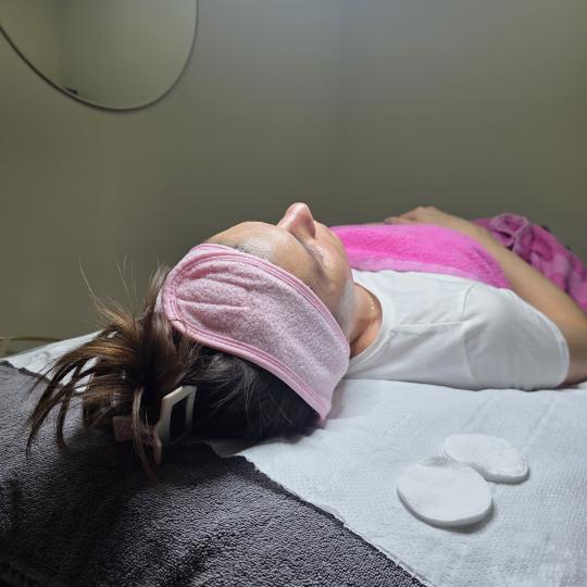 Starmedic #beograd Dermaroler i dermapen Holivudski sjaj - Jessner