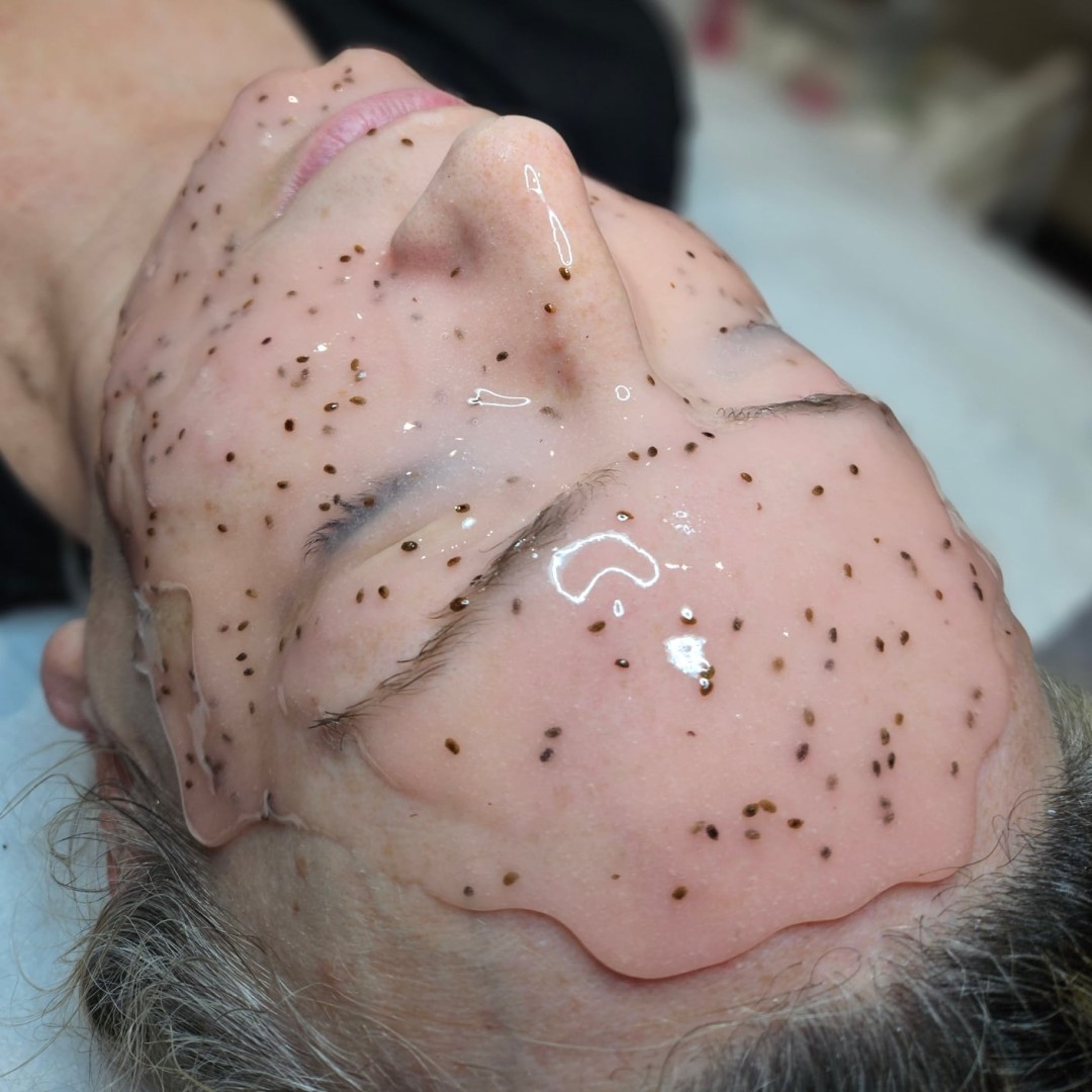 Starmedic #beograd Tretman lica Hydrafacial - tretman lica 5 u 1