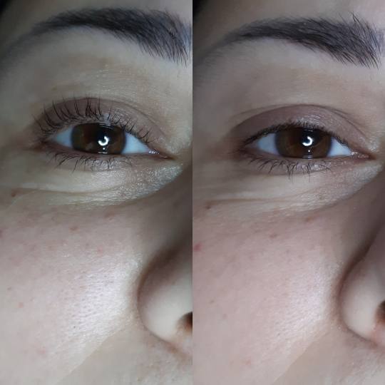 Tag Beauty Bar #beograd Trepavice Lash lift na kratkim trepavicama Lash lift + botox trepavica