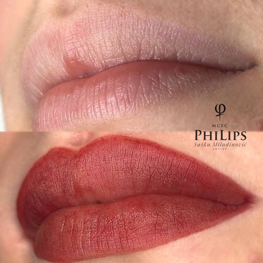 Esthetique Privé #beograd Trajna šminka Trajna šminka usana - PHILIPPS