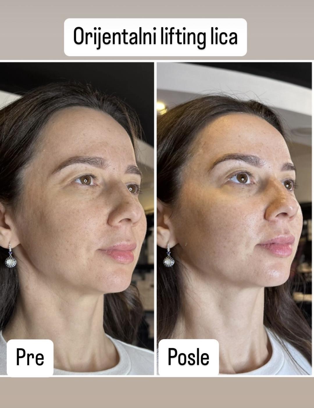 Orijent lifting tretman - Petra beauty concept, Beograd Tretman lica Lice Tretman lica, Beograd, Vračar, Čubura, Crveni krst