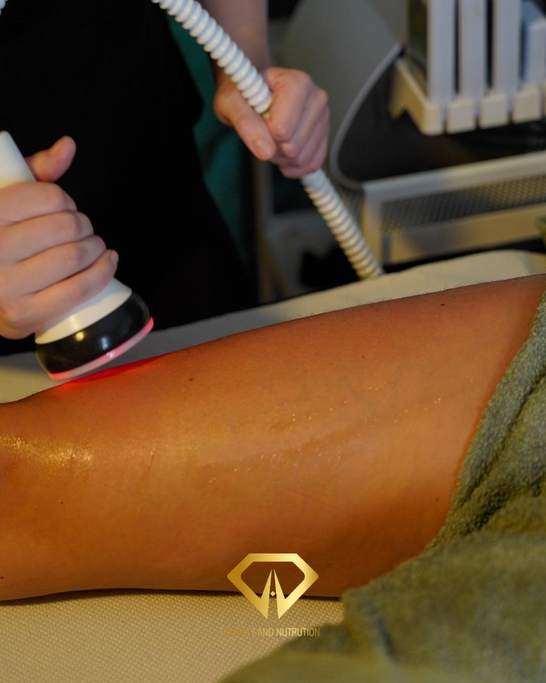 Beauty and nutrition #beograd Tretmani tela Vakum sonda nogu + gluteus