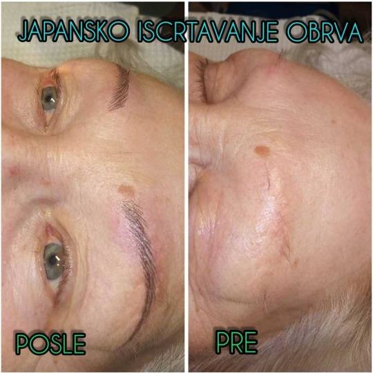 Grossi cosmetic #beograd