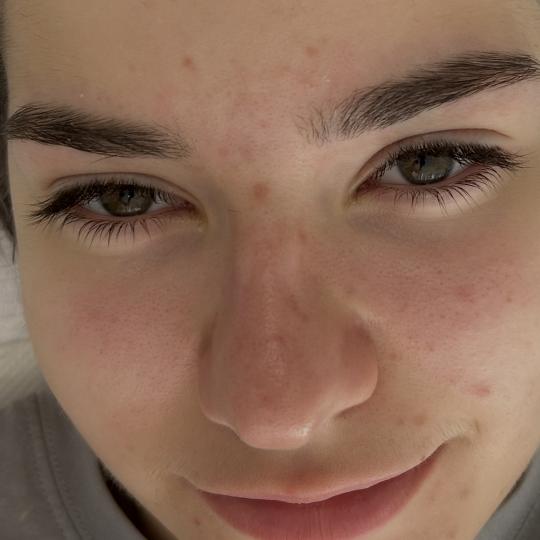Sandra estetik studio #beograd Tretman lica Higijenski tretman lica Veliko bravo za moju mladu klije
