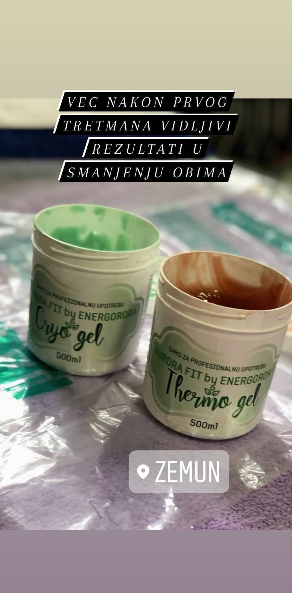 Studio 3S #beograd Body wrap / pakovanja Vakum fit + limfna dranaža