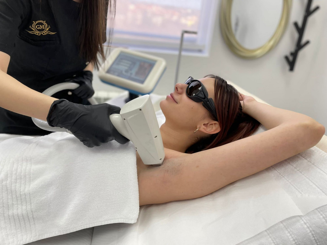 GM Beauty studio #beograd Laserska epilacija Laserska epilacija pazuha - za dame