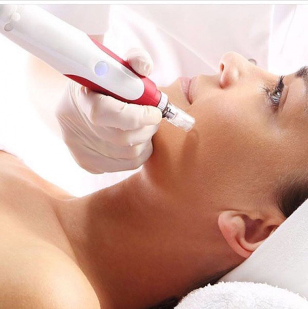 Vortex #beograd Mezoterapija lica Mezoterapija lica dermapenom