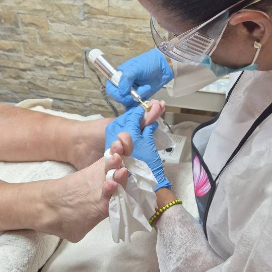 Bellavana studio #krusevac Medicinski pedikir Medicinski pedikir - manje problematičan