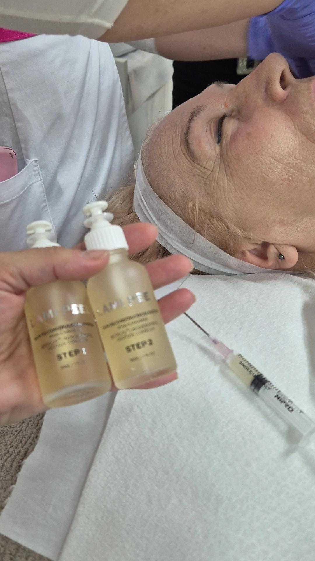 Nega lica i tela kod Gorice #beograd Tretman lica Esthemax biološki tretman + hemijski piling