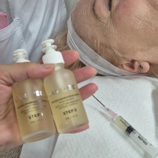 Nega lica i tela kod Gorice #beograd Tretman lica Esthemax biološki tretman + hemijski piling Anti 