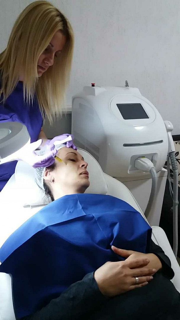 Ordinacija Epil Medic #beograd Tretman lica PRP tretman lica