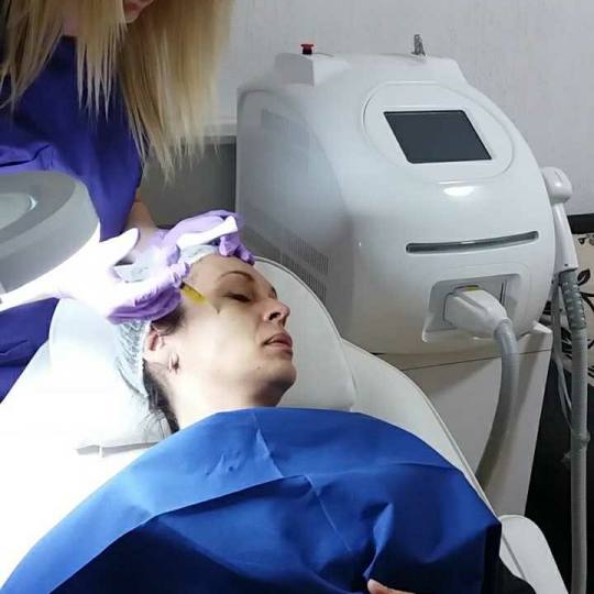 Ordinacija Epil Medic #beograd Tretman lica PRP tretman lica PRP lifting