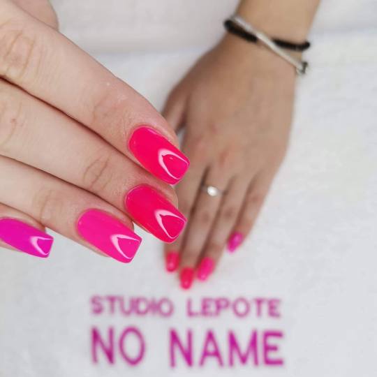 No name #kragujevac Izlivanje noktiju