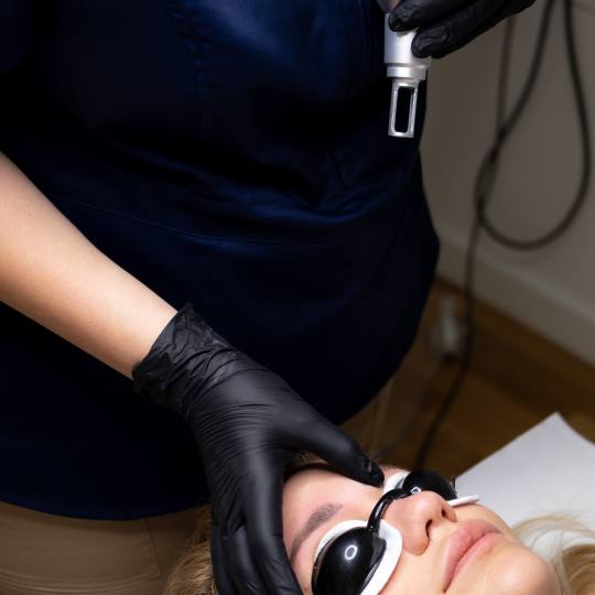Brow & Glow #novisad Laserski tretmani lica Lasersko uklanjanje obrva