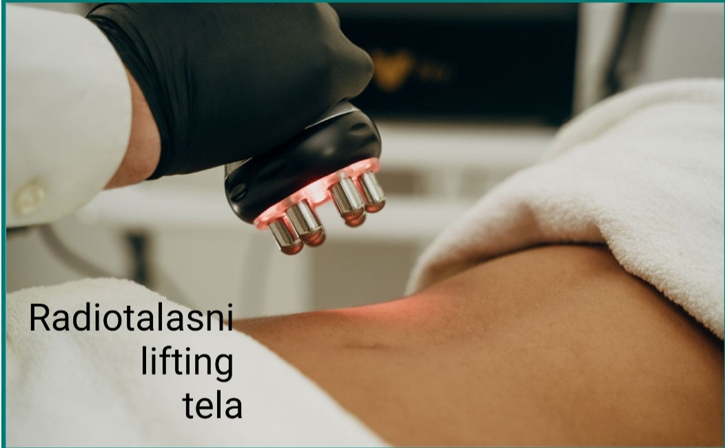 Laser centar Delight #beograd Lifting / zatezanje kože Radiotalasni lifting tela - tretman zatezanja kože i nabora po regiji