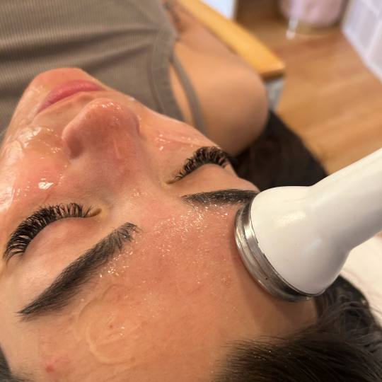 Esthetique Privé #beograd Tretman lica Hydrafacial tretman lica + čišćenje lica