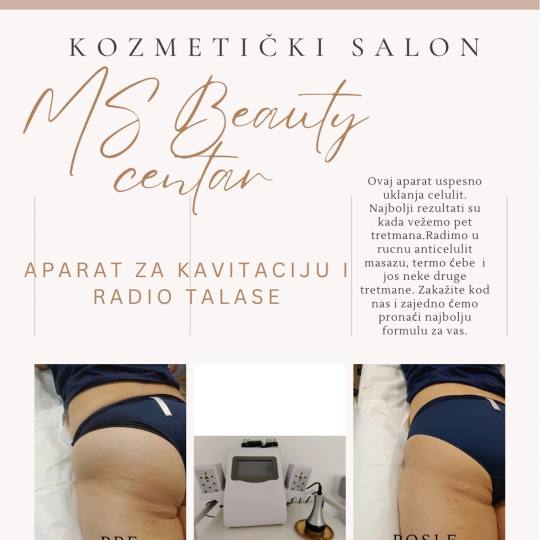 MS Beauty Centar #beograd
