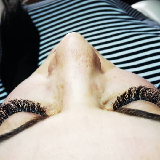 Derma Life #beograd Nadogradnja svilenih trepavica 1 na 1