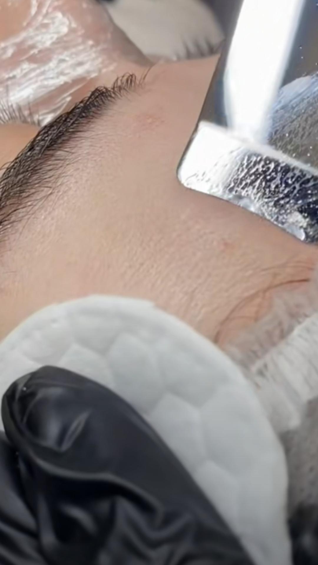 HydraClean Facial -(Hydrafacial+mehaničko čišćenje lica) - Esthetique Privé, Beograd Tretman lica Lice Tretman lica, Beograd, Centar, Stari grad, Dorćol
