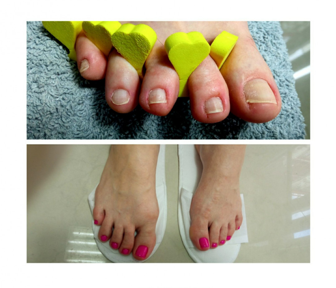 Gaga G&T #beograd Estetski pedikir Ruski pedikir + gel lak - rubber baza
