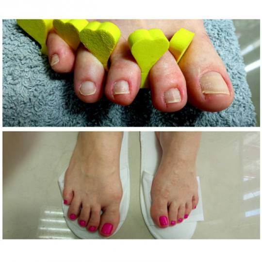 Gaga G&T #beograd Estetski pedikir Ruski pedikir + gel lak - rubber baza Ruski pedikir - rad sa nast