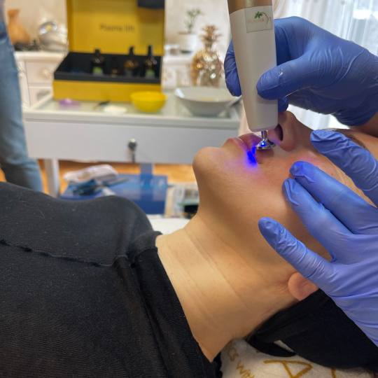 Lancier Beauty Expert #beograd Tretman lica Plazma lift lica - jedna regija