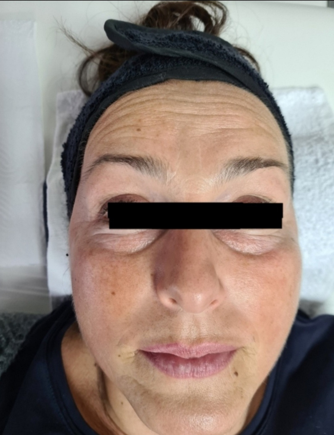 SunBox #beograd Masaža lica Face gym / Face fitness - anti age masaža lica