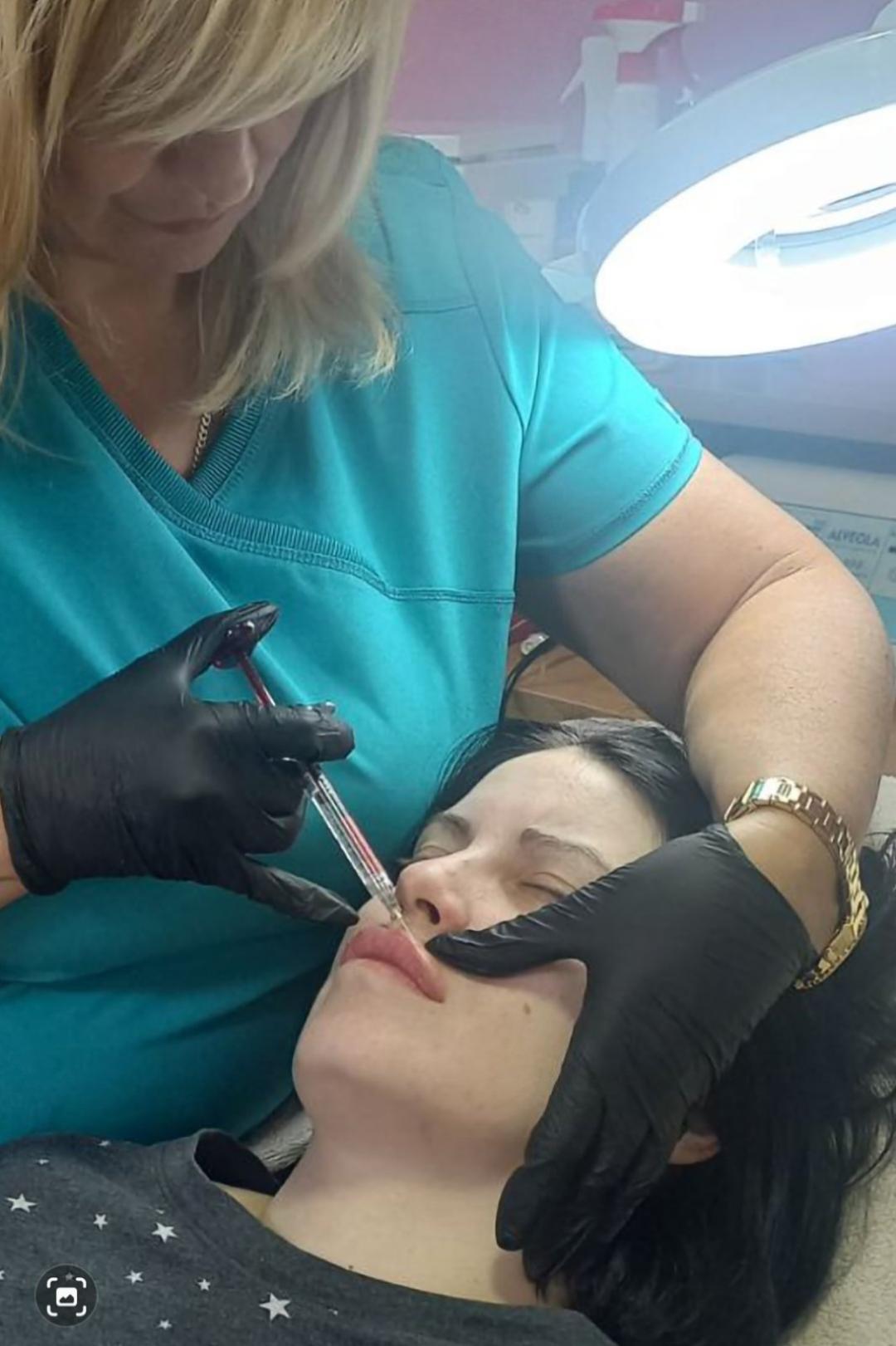 Afrodita gold #kragujevac Hijaluronski tretmani lica Tretman lica hijaluronskim filerima