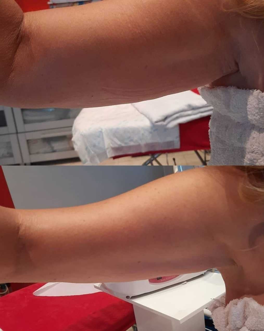 Grossi cosmetic #beograd
