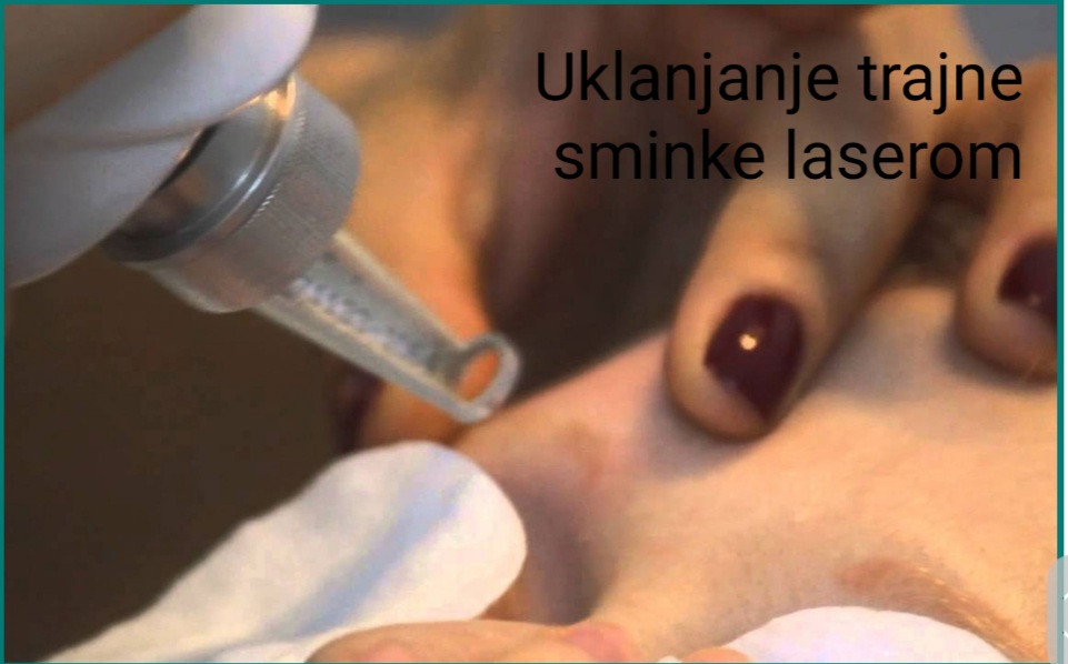 Laser centar Delight #beograd Trajna šminka Uklanjanje trajne šminke laserom obrva ili usana