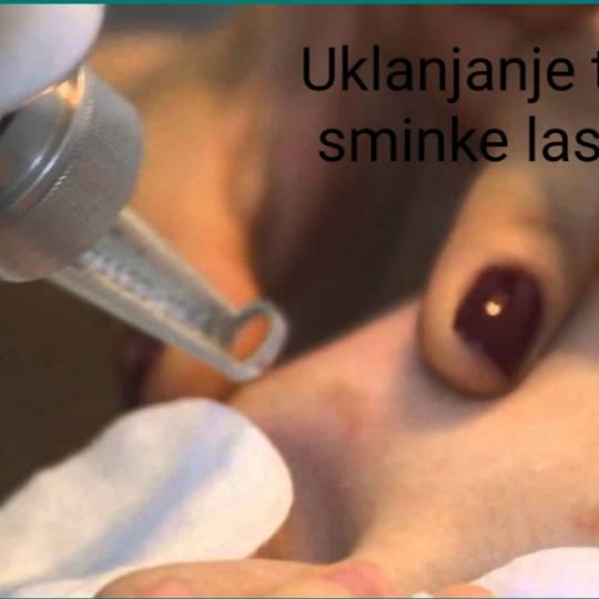 Laser centar Delight #beograd Trajna šminka Uklanjanje trajne šminke laserom obrva ili usana