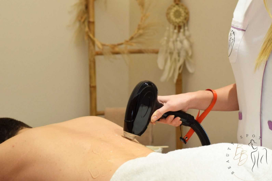 B&B Beauty Spot, Novi Sad Laserska epilacija
