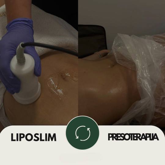 Lumière studio #beograd Anticelulit masaža Liposlim tretman tela - 1 regija Kada spojite LipoSlim 