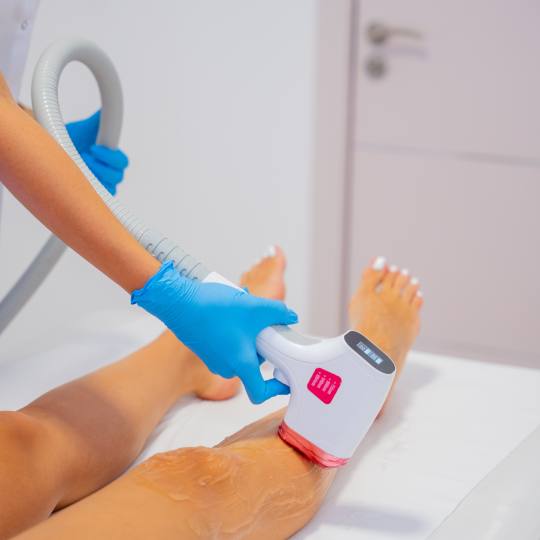 Monika Barta Cosmetics #novisad Laserska epilacija 3R Laserska epilacija cele noge+ pazusi+ intima+ 