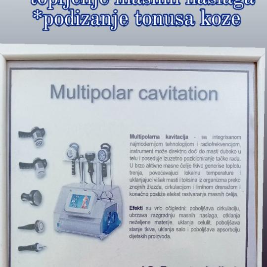 Astradas 2 #beograd Kavitacija Multipolarna kavitacija