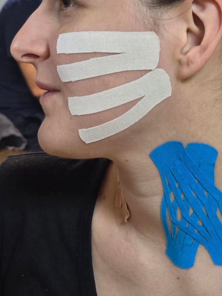 Sinergija #beograd Masaža lica Kinezio tape-lice