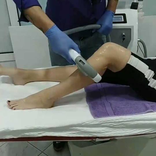 AltaBella Batajnica #beograd Laserska epilacija Laserska epilacija potkolenica - za dame