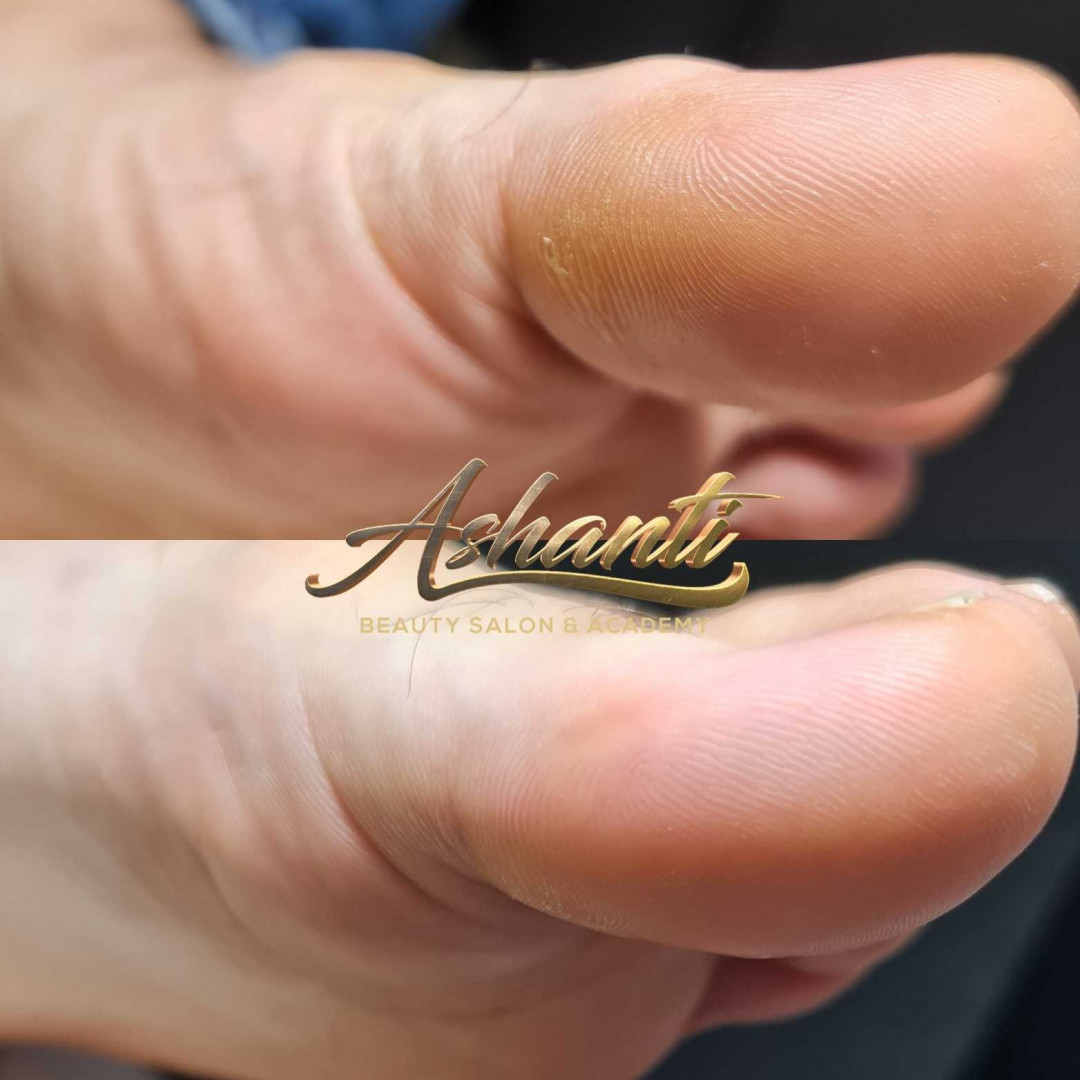 Ruski pedikir + lakiranje noktiju - Ashanti Beauty Salon & Academy, Beograd Estetski pedikir Nokti Estetski pedikir, Beograd, Voždovac