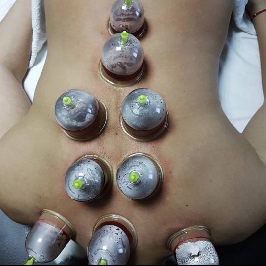 Ad Astra Spa & Epil House #beograd Tretmani tela Hidžama u ponudi u salonu Ad Astra spa & epil hous