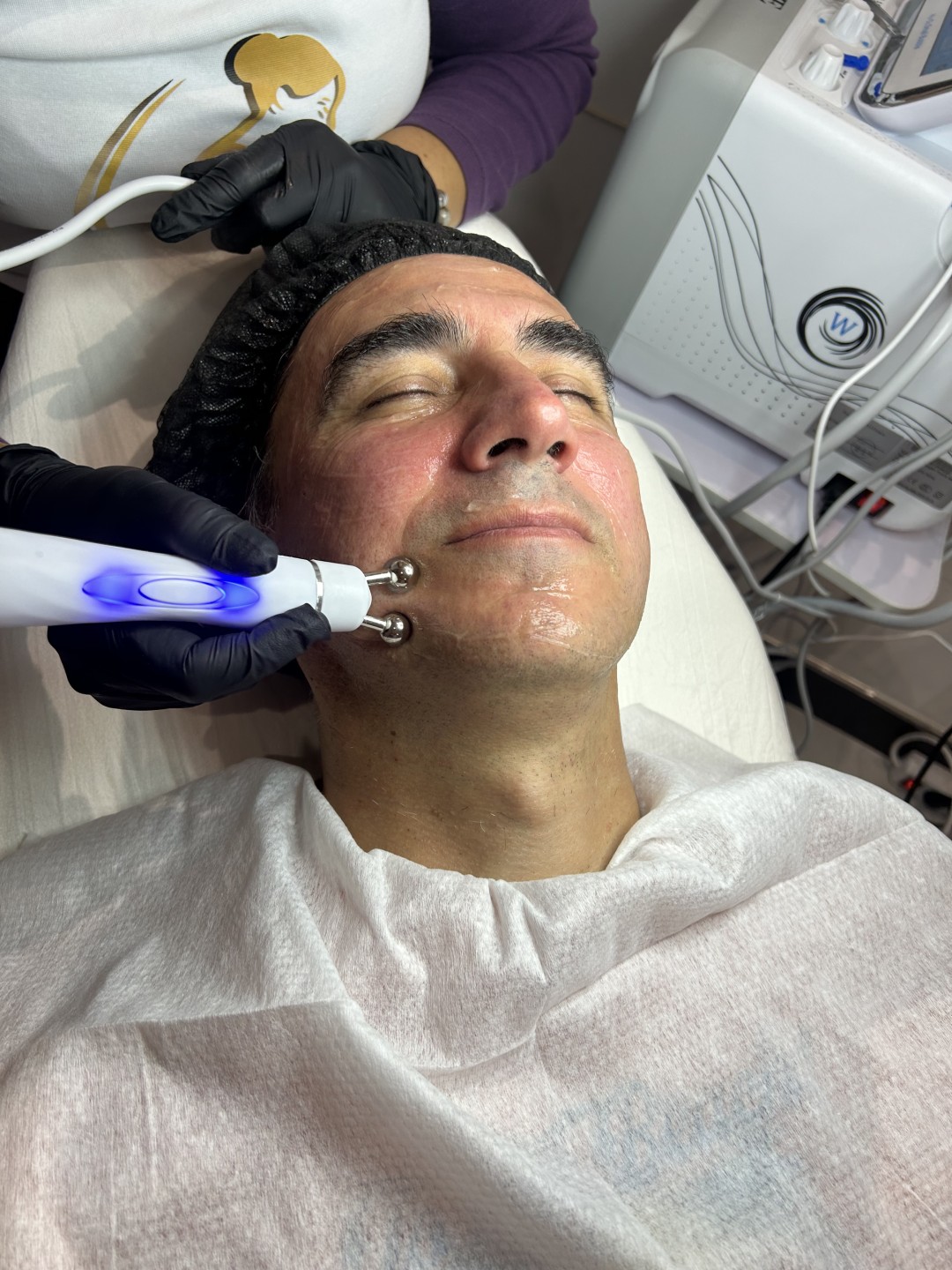 Odraz lepote #beograd Tretman lica Hydrafacial 7 y 1 tretman lica