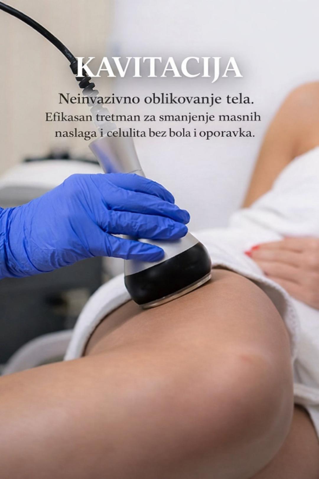 Kavitacija - Afrodita gold, Kragujevac Kavitacija Telo Kavitacija, Kragujevac, Centar