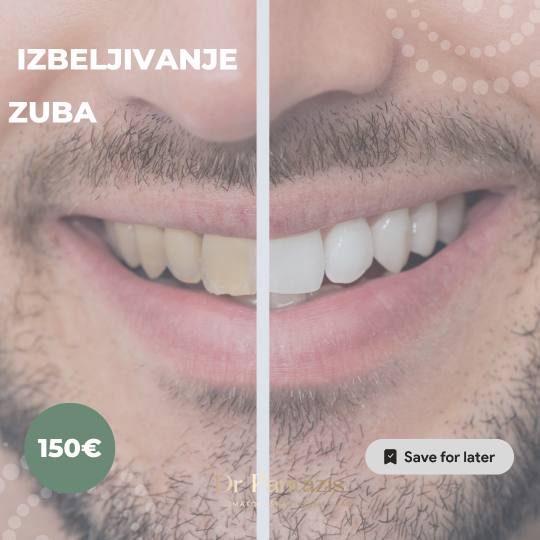 Dr Pantazis - Dental & Beauty Clinic #beograd Zubi Lasersko Profesionalno Izbeljivanje Zuba