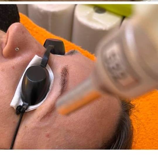 Studio lepote i edukativni centar Helios #kikinda Trajna šminka Lasersko uklanjanje trajne šminke 